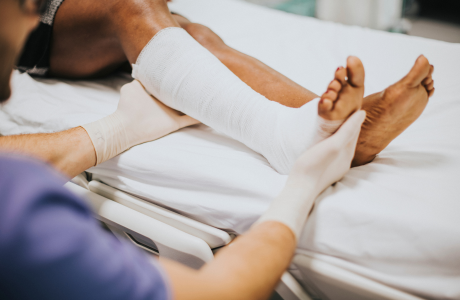 Limb Preservation Surgeries